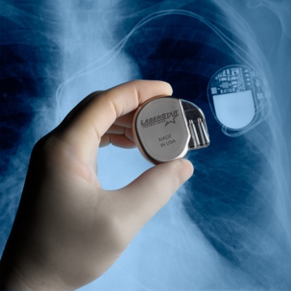 Pacemaker Marking